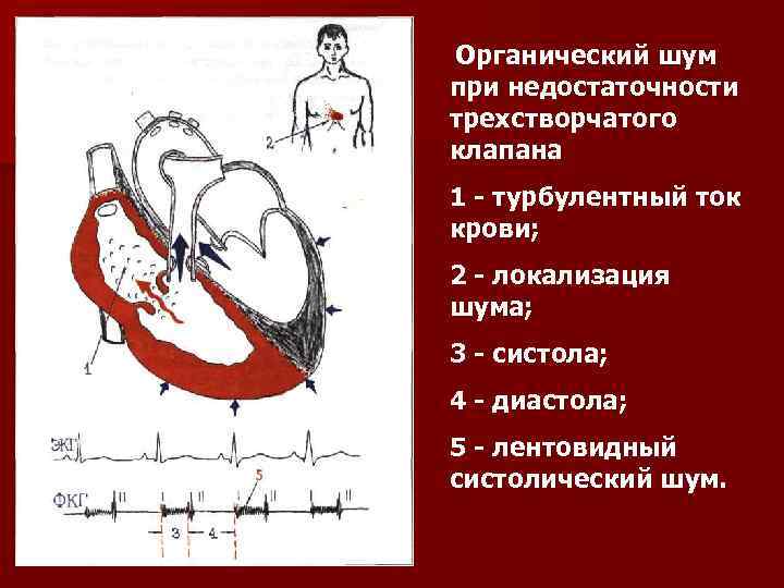 Трикуспидальный клапан сердца