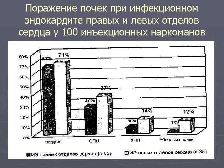 Поражение почек при инфекционном эндокардите правых и левых отделов сердца у 100 инъекционных наркоманов