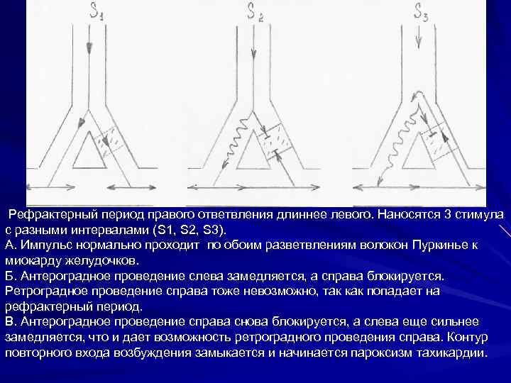 Левая длиннее правой