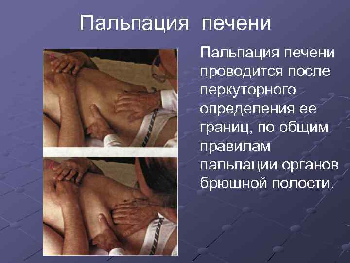 Пальпация печени проводится после перкуторного определения ее границ, по общим правилам пальпации органов брюшной