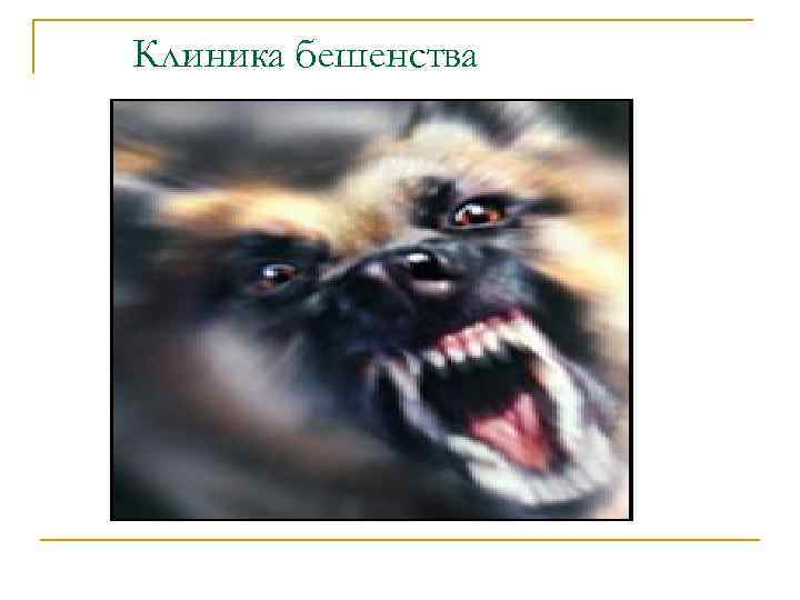 Клиника бешенства 