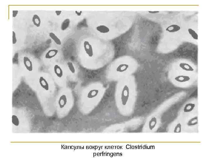 Капсулы вокруг клеток Clostridium perfringens 