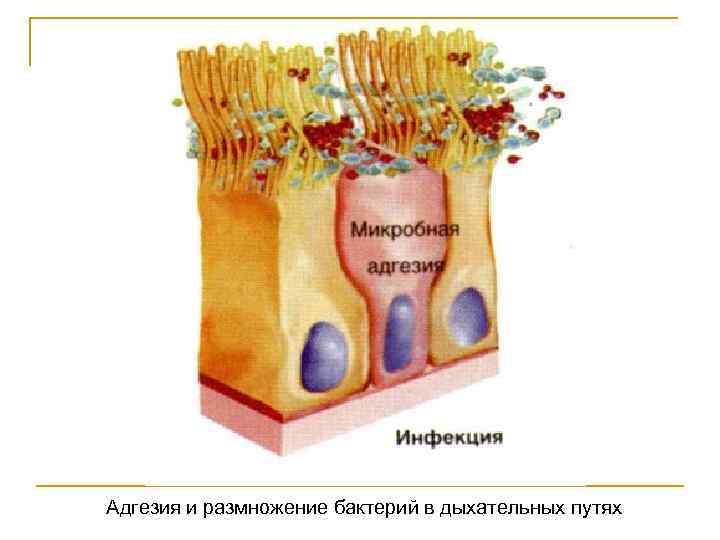Адгезия и размножение бактерий в дыхательных путях 
