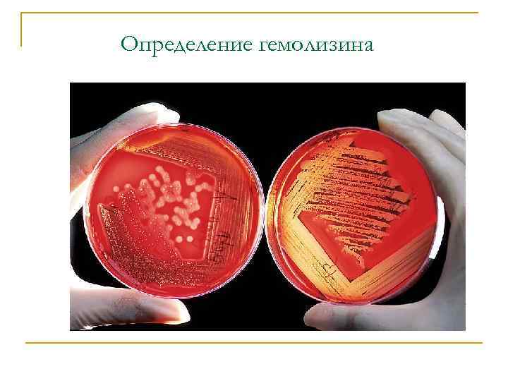 Определение гемолизина 