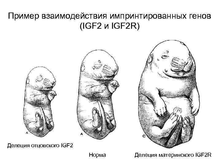 Пример взаимодействия импринтированных генов (IGF 2 и IGF 2 R) Делеция отцовского IGF 2