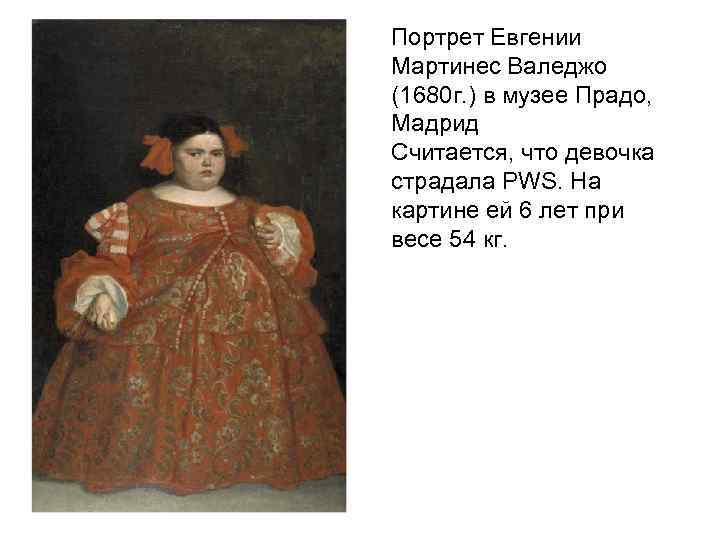 Портрет Евгении Мартинес Валеджо (1680 г. ) в музее Прадо, Мадрид Считается, что девочка