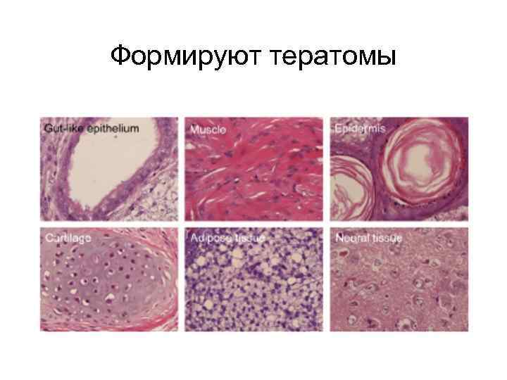 Формируют тератомы 