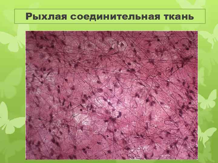 Рыхлая соединительная ткань 
