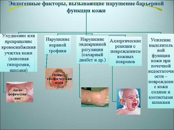 Эндогенные факторы, вызывающие нарушение барьерной функции кожи Ухудшение или прекращение кровоснабжения участка кожи (венозная