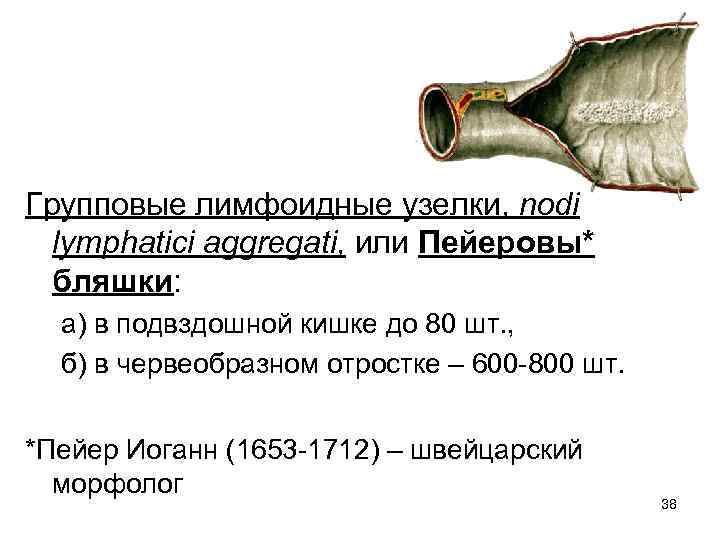 Групповые лимфоидные узелки, nodi lymphatici aggregati, или Пейеровы* бляшки: а) в подвздошной кишке до