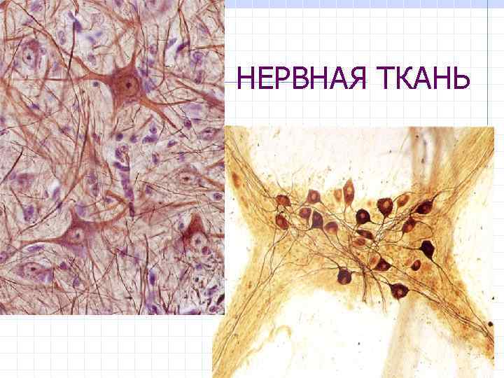 Нервная ткань гистология презентация