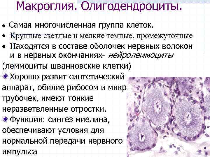 Макроглия. Олигодендроциты. · Самая многочисленная группа клеток. · Крупные светлые и мелкие темные, промежуточные