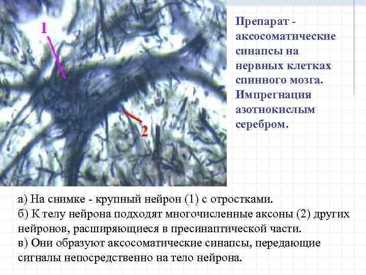 Препарат - аксосоматические синапсы на нервных клетках спинного мозга. Импрегнация азотнокислым серебром. а) На