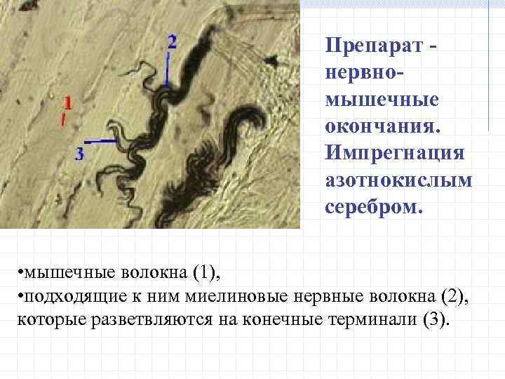 Препарат - нервномышечные окончания. Импрегнация азотнокислым серебром. • мышечные волокна (1), • подходящие к