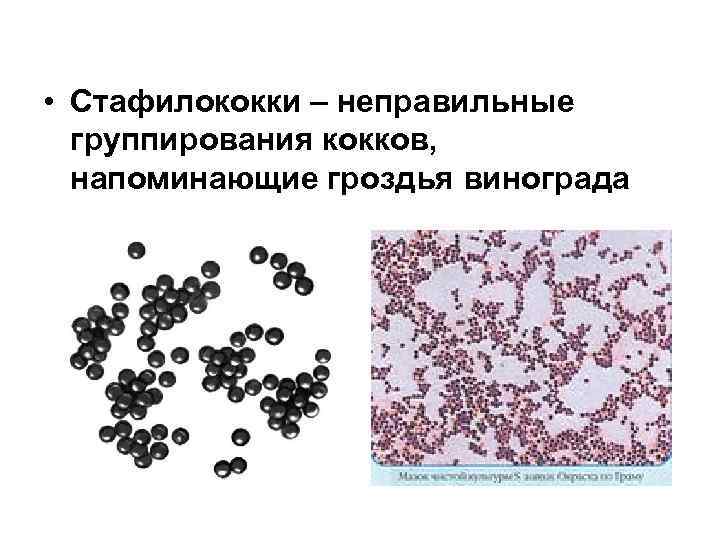  • Стафилококки – неправильные группирования кокков, напоминающие гроздья винограда 