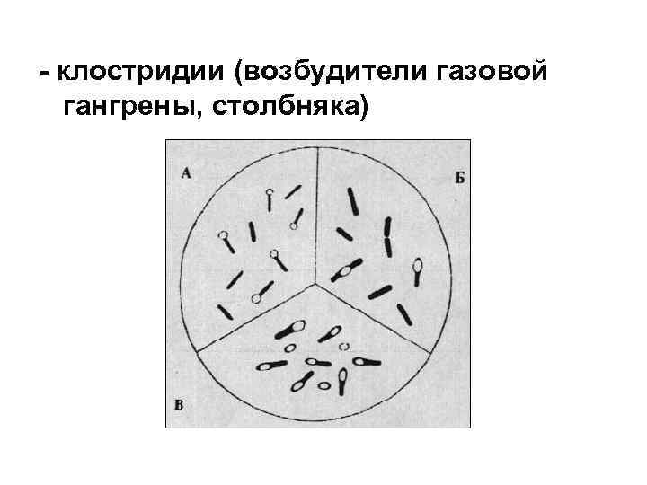 Газовая гангрена микробиология презентация