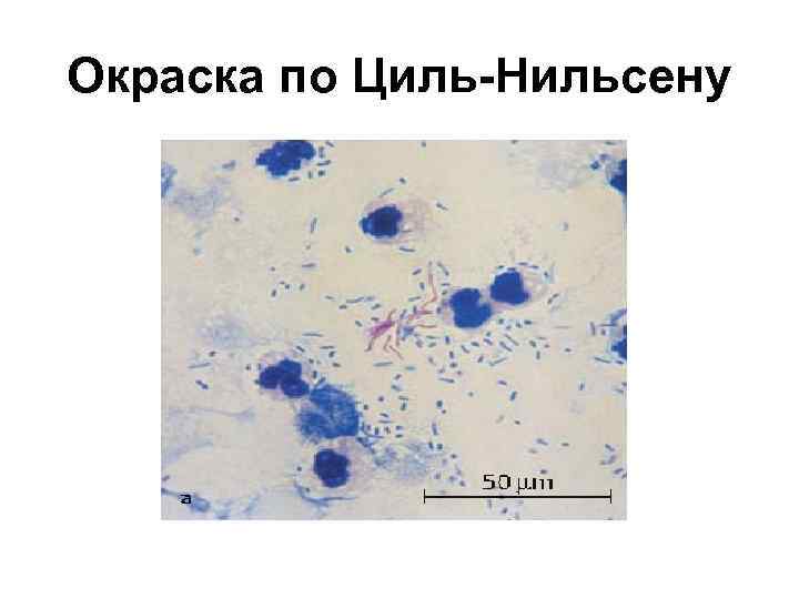 Окраска по трухио картинки