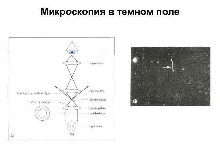 Микроскопия в темном поле 