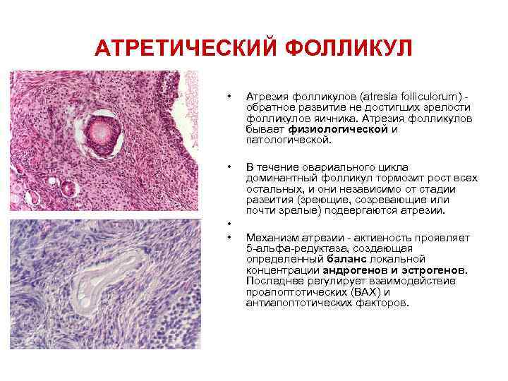 Что такое фолликулы. Атретическое тело яичника гистология. Атретический фолликул гистология препарат. Атретический фолликул строение. Атретические фолликулы яичника.