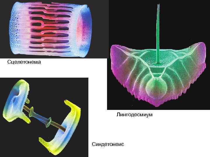 Сцелетонема Линтодесмиум Синдетонеис 