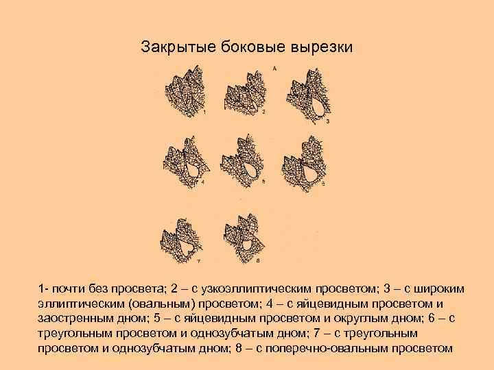 Закрытые боковые вырезки 1 - почти без просвета; 2 – с узкоэллиптическим просветом; 3