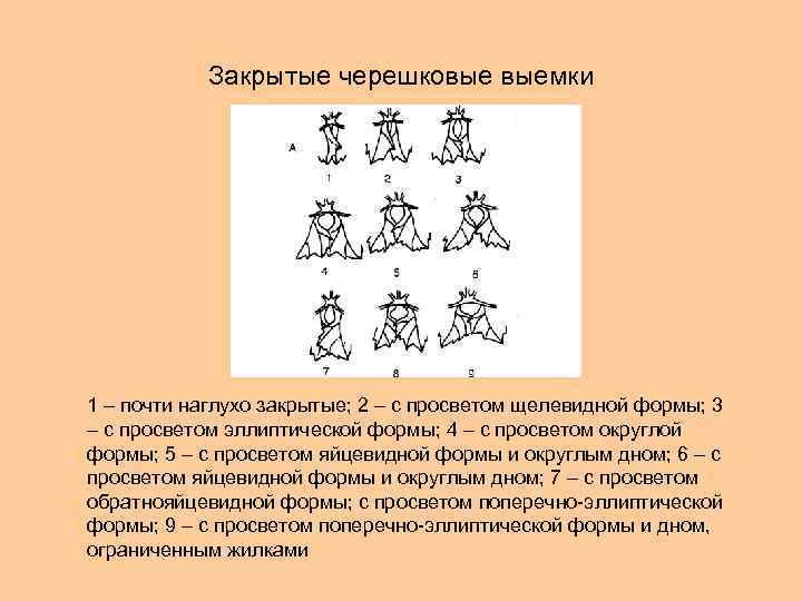 Закрытые черешковые выемки 1 – почти наглухо закрытые; 2 – с просветом щелевидной формы;