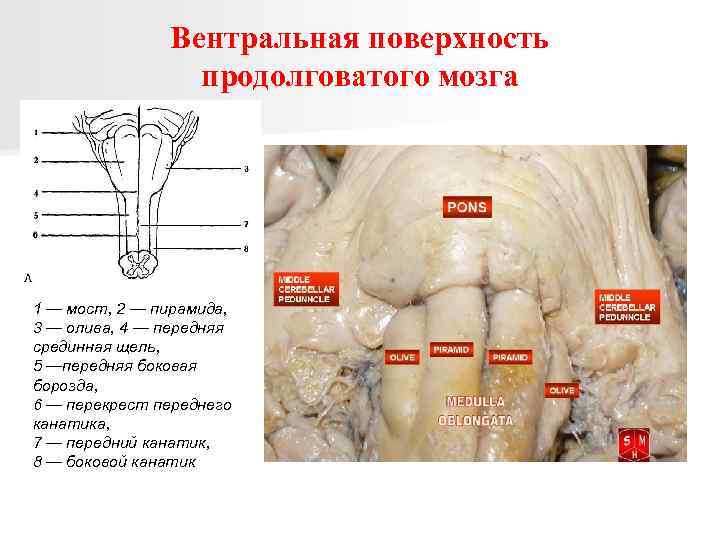 Вентральная поверхность продолговатого мозга 1 — мост, 2 — пирамида, 3 — олива, 4