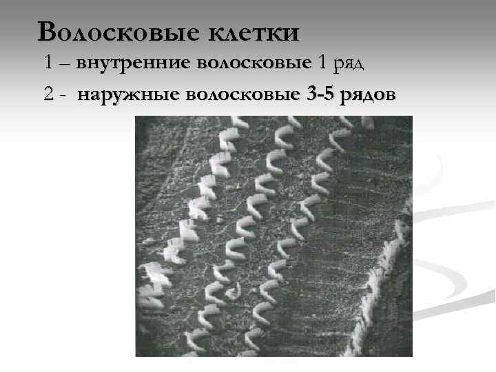 Волосковые клетки 1 – внутренние волосковые 1 ряд 2 - наружные волосковые 3 -5