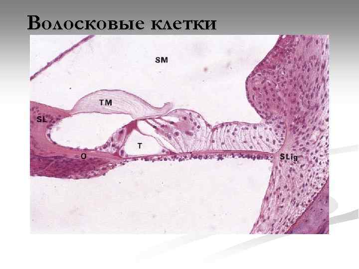 Волосковые клетки 