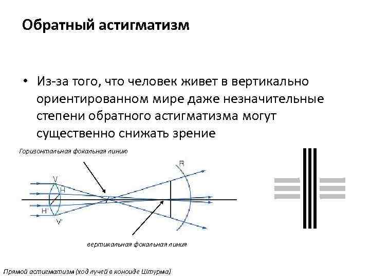 Обратный астигматизм • Из-за того, что человек живет в вертикально ориентированном мире даже незначительные