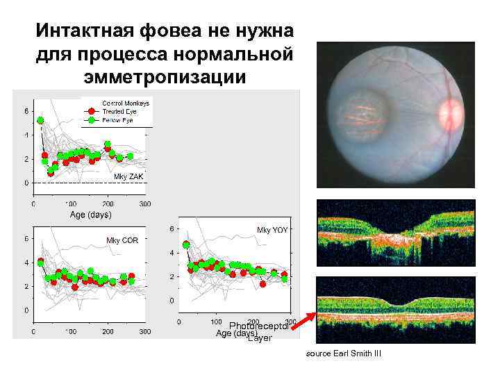 Интактная фовеа не нужна для процесса нормальной эмметропизации Photoreceptor Layer source Earl Smith III