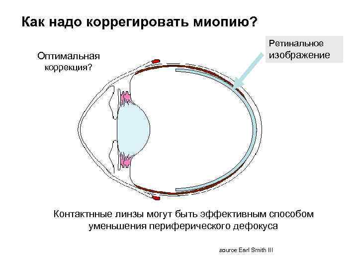 Ретинальное изображение это