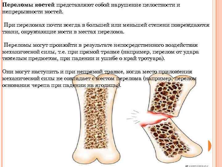 Переломы костей представляют собой нарушение целостности и непрерывности костей. При переломах почти всегда в