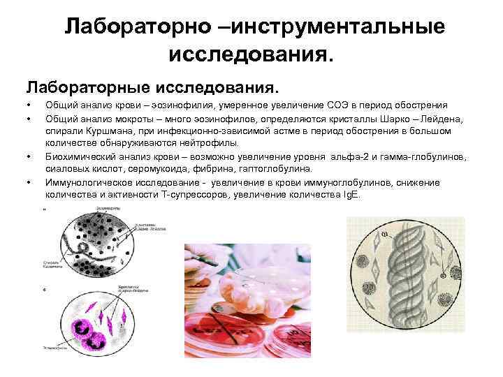 Лабораторно –инструментальные исследования. Лабораторные исследования. • • Общий анализ крови – эозинофилия, умеренное увеличение