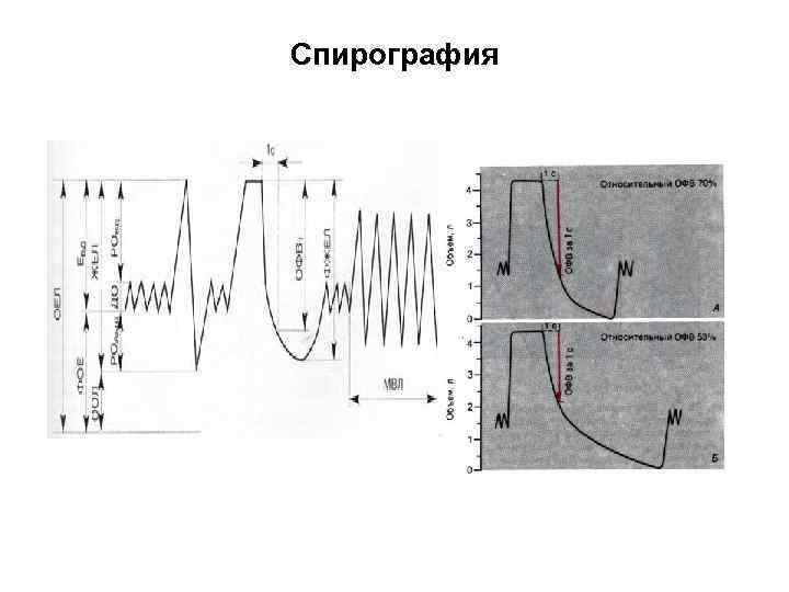 Спирография при астме