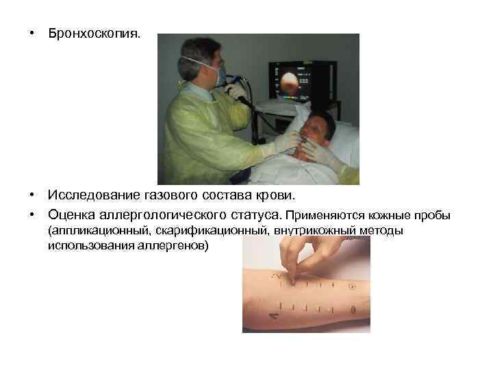  • Бронхоскопия. • Исследование газового состава крови. • Оценка аллергологического статуса. Применяются кожные