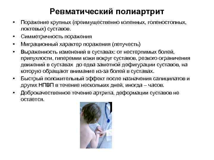 Ревматический полиартрит • • • Поражение крупных (преимущественно коленных, голеностопных, локтевых) суставов. Симметричность поражения