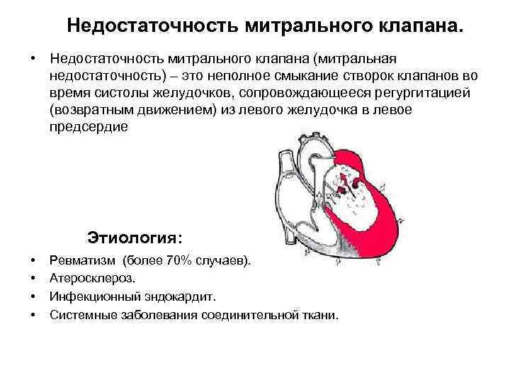 Недостаточность митрального клапана. • Недостаточность митрального клапана (митральная недостаточность) – это неполное смыкание створок