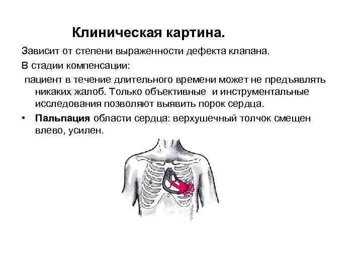 Клиническая картина. Зависит от степени выраженности дефекта клапана. В стадии компенсации: пациент в течение
