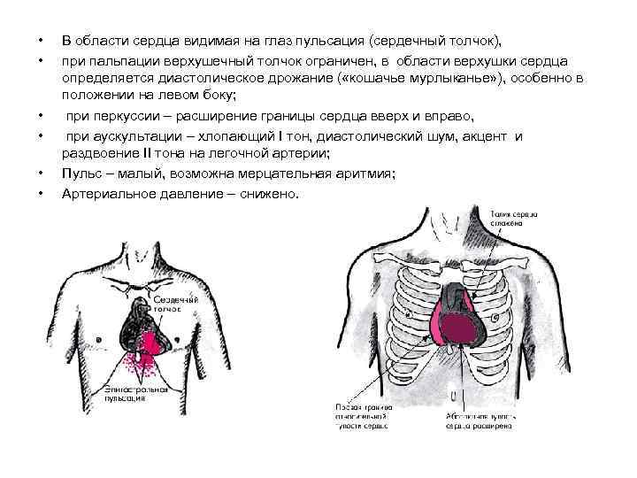 Острая ревматическая лихорадка картинки