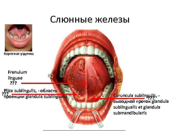 Слюнные железы Короткая уздечка Frenulum linguae ? ? ? Plica sublingulis, - область ?