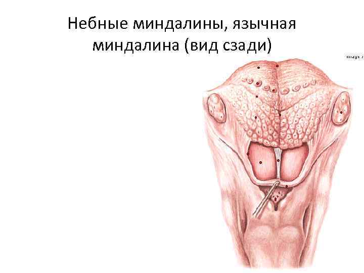 Небные миндалины, язычная миндалина (вид сзади) 