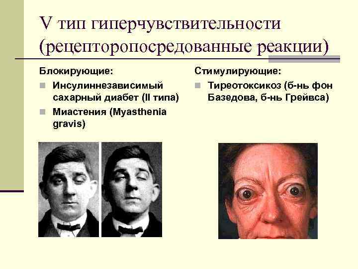 V тип гиперчувствительности (рецепторопосредованные реакции) Блокирующие: n Инсулиннезависимый сахарный диабет (II типа) n Миастения
