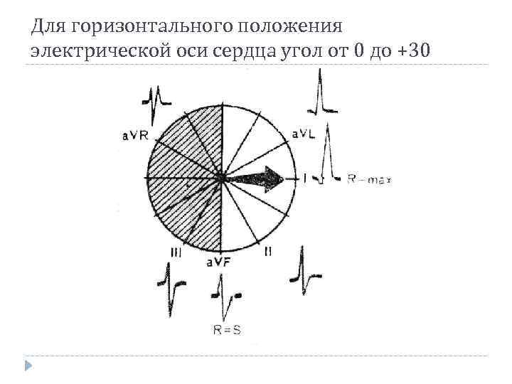 Для горизонтального положения электрической оси сердца угол от 0 до +30 