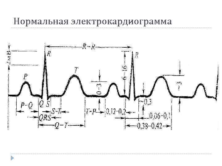Нормальная электрокардиограмма 