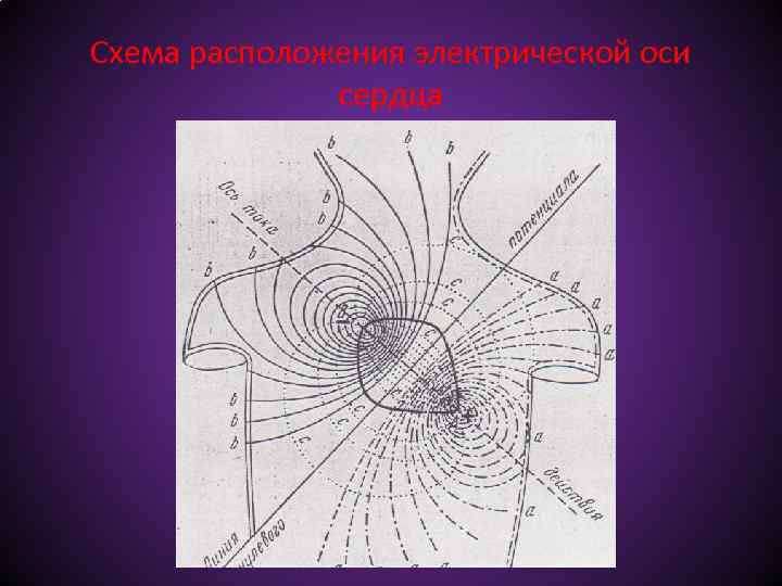 Схема расположения электрической оси сердца 