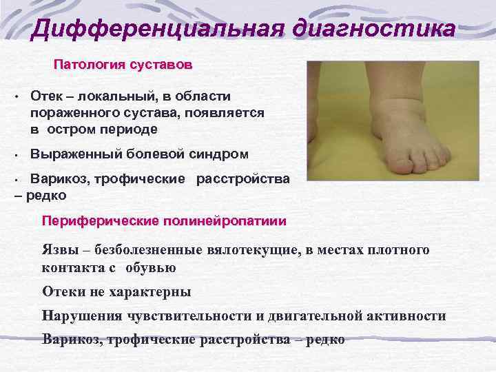 Дифференциальная диагностика Патология суставов • • Отек – локальный, в области пораженного сустава, появляется