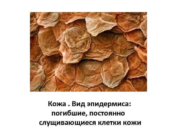 Кожа. Вид эпидермиса: погибшие, постоянно слущивающиеся клетки кожи 