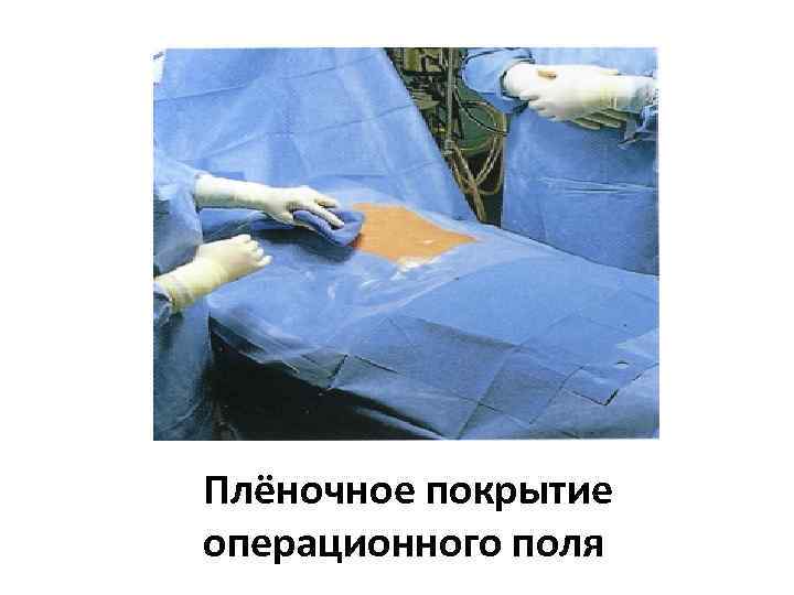 Плёночное покрытие операционного поля 
