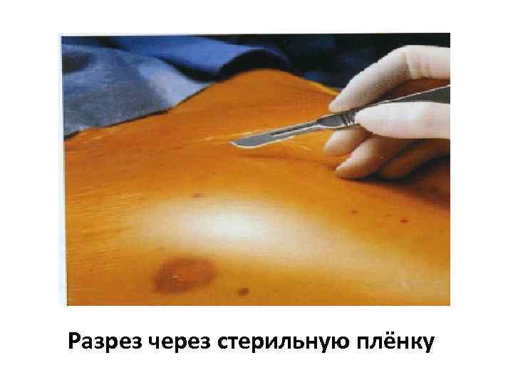 Разрез через стерильную плёнку 